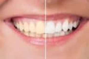 Best Dentist in Delhi