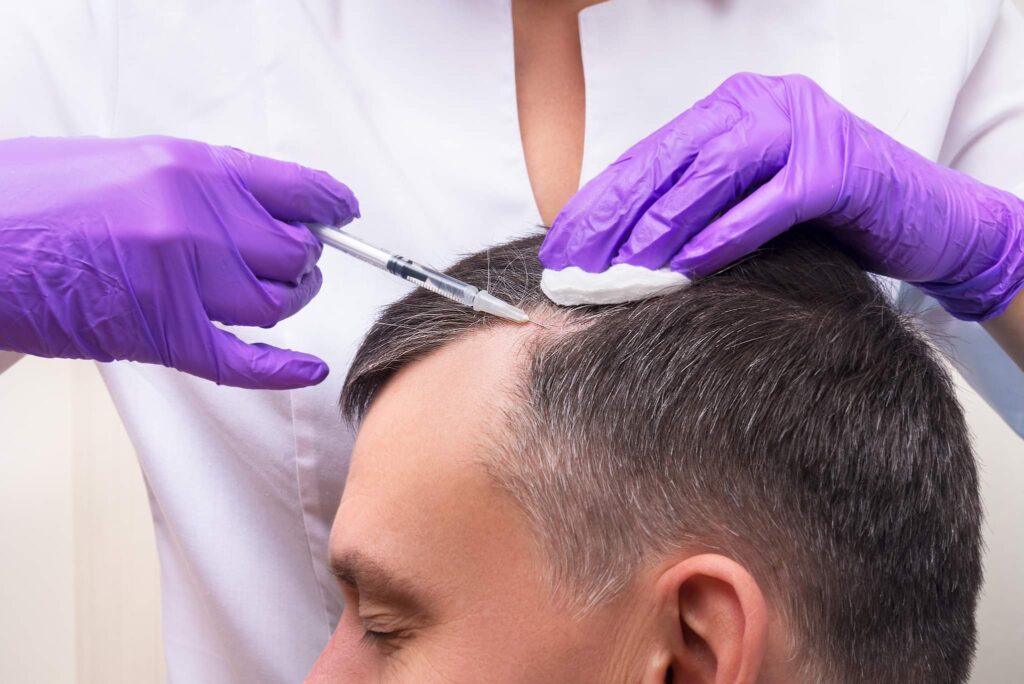 PRP Procedure For Hair Loss: Can PRP Regrow Hair?