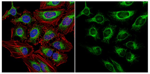 Calnexin (C5C9) Rabbit mAb from Cell Signaling Technology Calnexin (C5C9) Rabbit mAb from Cell Signaling Technology