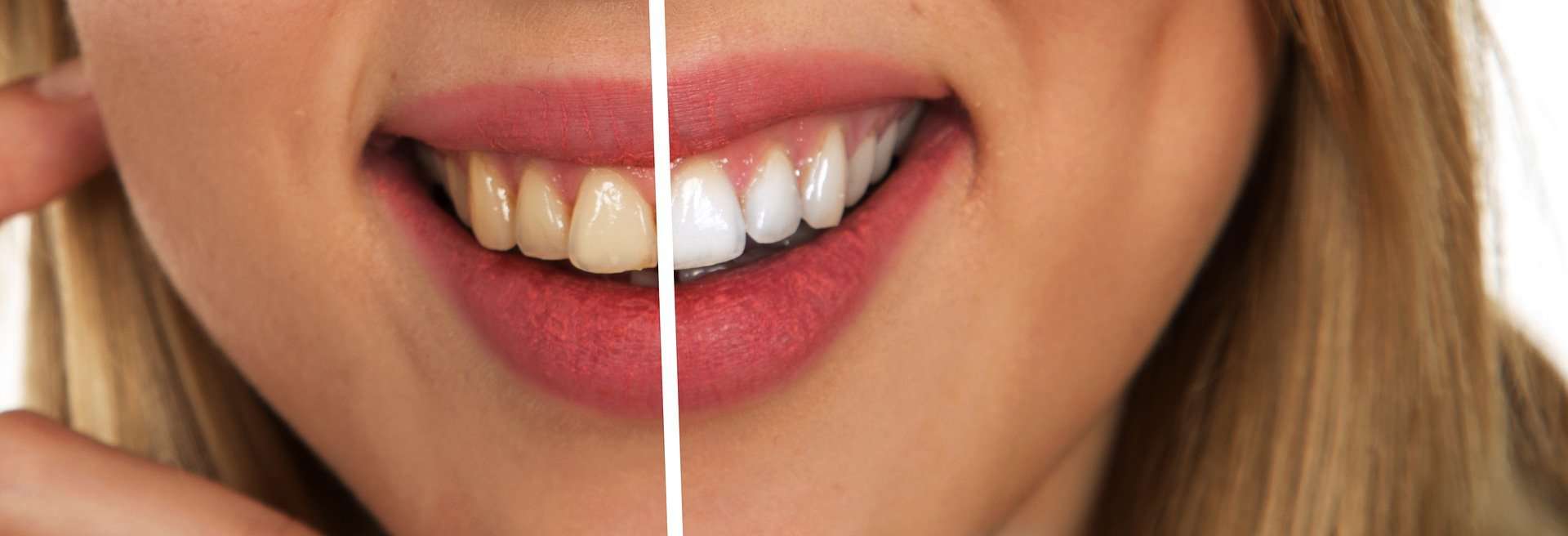 Cosmetic Dental