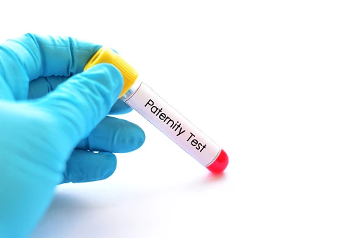 Learn About the Varying Paternity Test Costs.