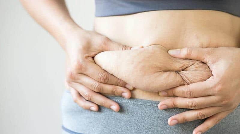 Belly Fat vs. Loose Skin- Issues Associated with Them Belly Fat vs. Loose Skin- Issues Associated with Them
