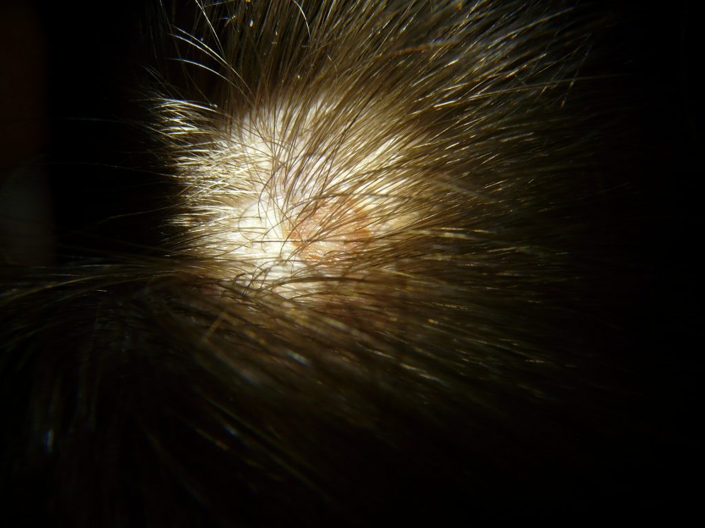 Easy Ways To Take Care of Your Scalp