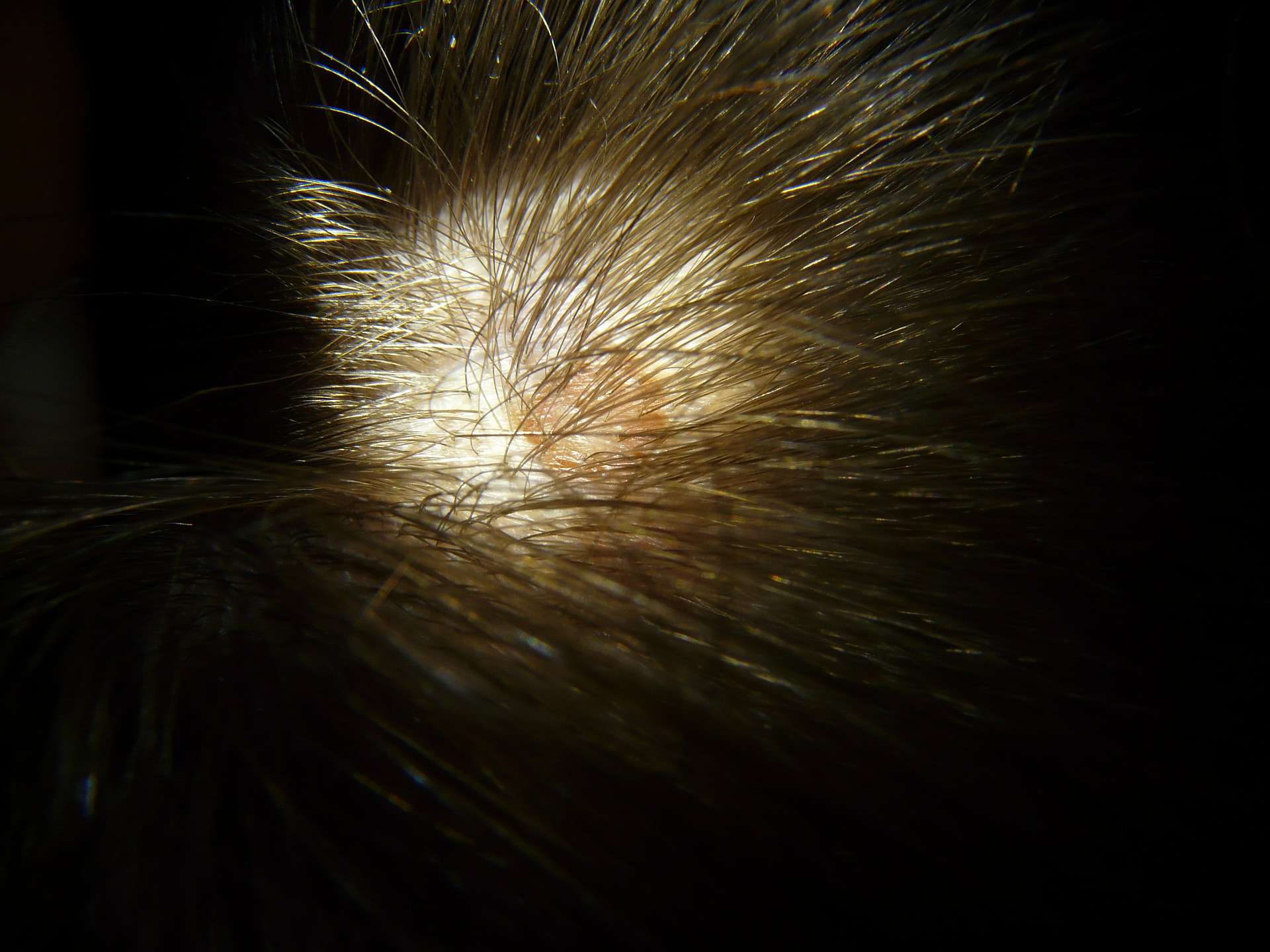 Scalp