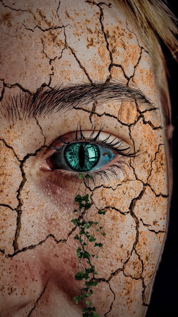Cold Weather Causing Dry Skin? Try These Hacks. Cold Weather Causing Dry Skin? Try These Hacks.
