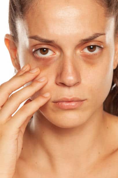 Top Essential Oils For Dark Circles – DIY Recipes & How to Use