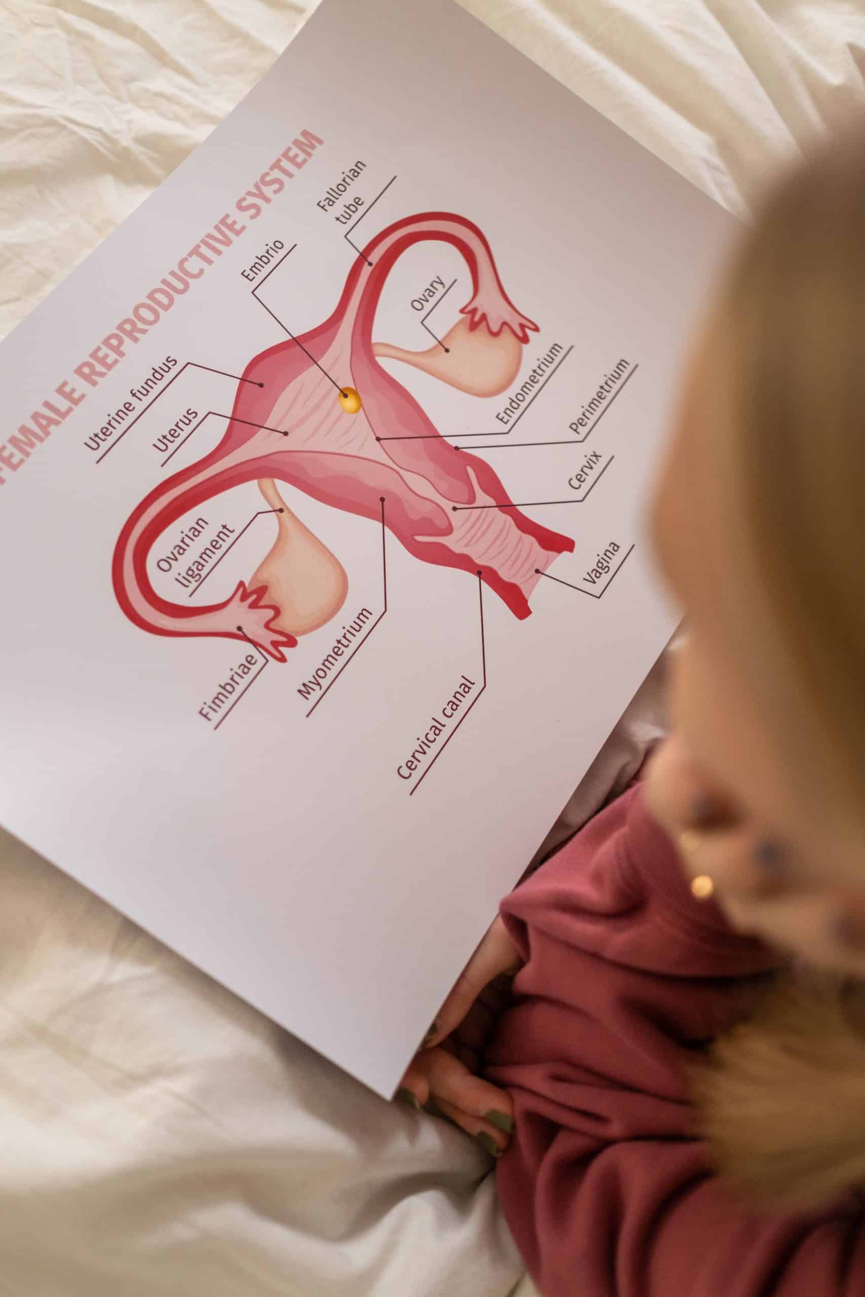 Polycystic Ovary Syndrome