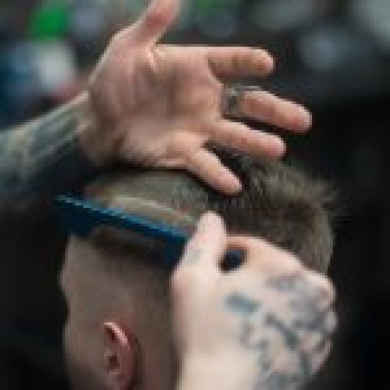 Hair Loss