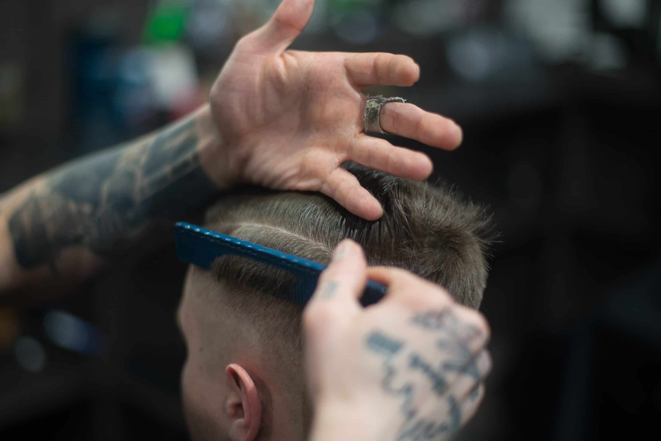 Hair Loss