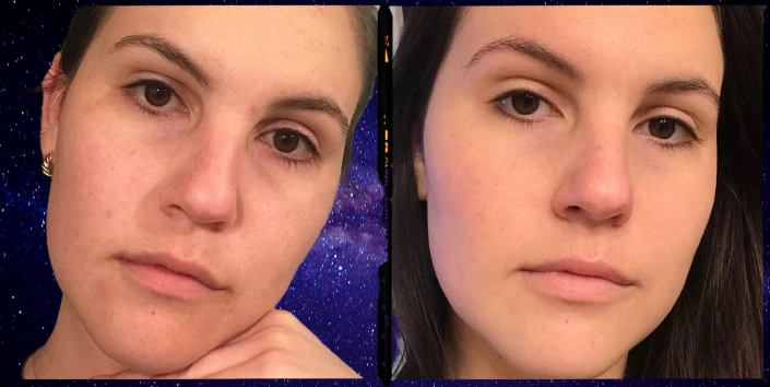 Curology: A Revolutionary Approach to Skincare for All Skin Types