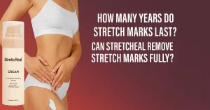 Woman applying Stretcheal Cream to visible stretch marks on thigh with product bottle and bold headline overlay