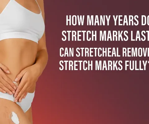 Woman Applying Stretcheal Cream To Visible Stretch Marks On Thigh With Product Bottle And Bold Headline Overlay