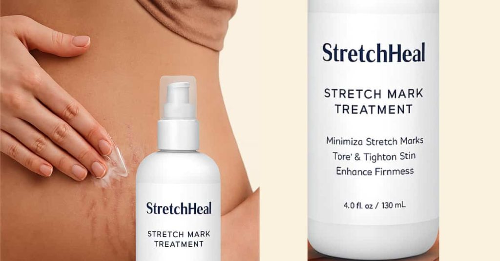 Stretcheal Cream