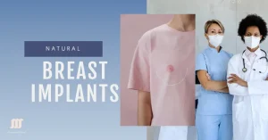 Medical professionals standing together with a person wearing a pink shirt depicting a breast implant diagram.