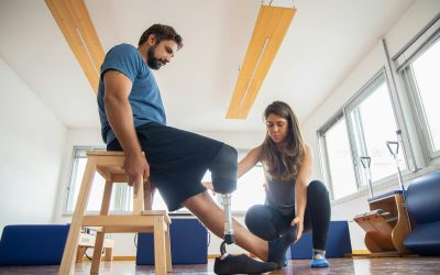 Physical therapist assisting a man with a prosthetic leg during rehabilitation exercises.